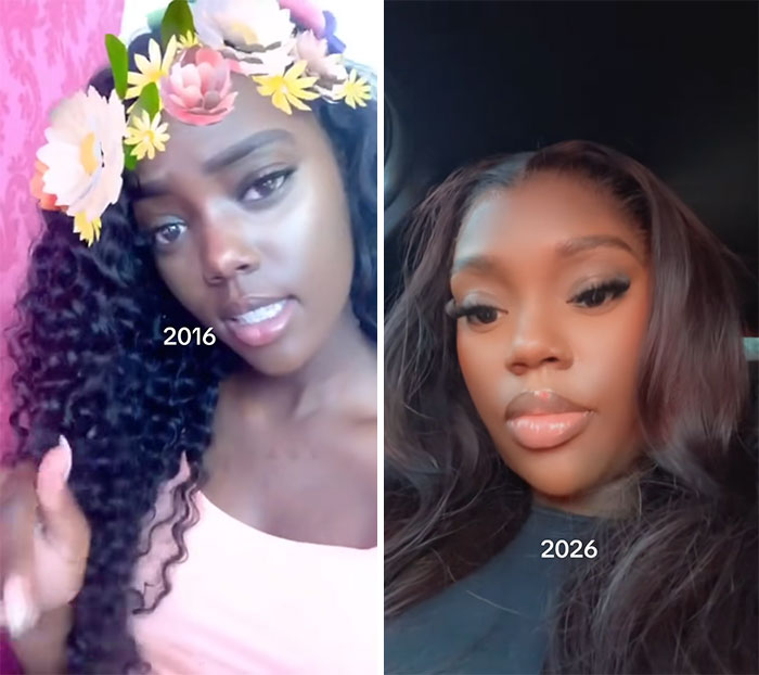 65 People Shared 2016 Vs. 2026 Photos, And Some Of Them Are Hard To Recognize