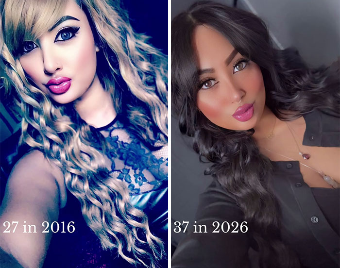 65 People Shared 2016 Vs. 2026 Photos, And Some Of Them Are Hard To Recognize