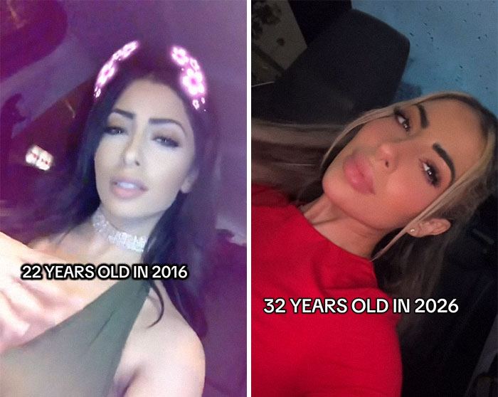 65 People Shared 2016 Vs. 2026 Photos, And Some Of Them Are Hard To Recognize