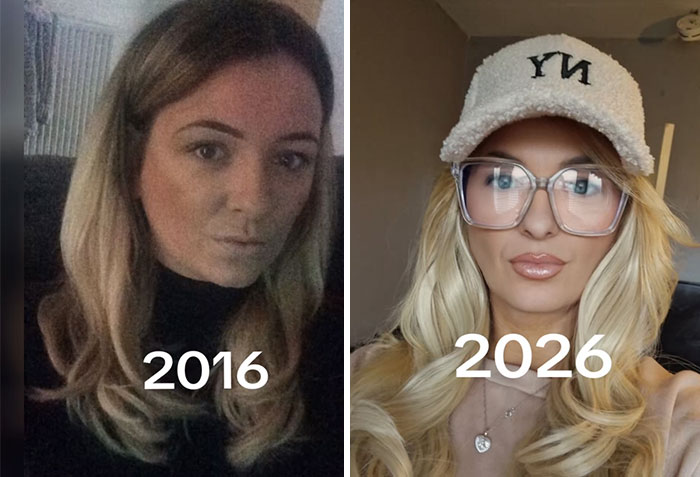 65 People Shared 2016 Vs. 2026 Photos, And Some Of Them Are Hard To Recognize