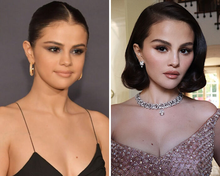Fans Blame Plastic Surgery For Selena Gomez’s “Unhinged” Transformation In Recent Snaps