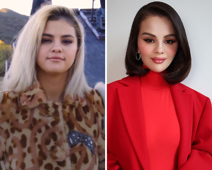 Fans Blame Plastic Surgery For Selena Gomez’s “Unhinged” Transformation In Recent Snaps