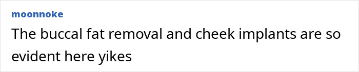 Fans Blame Plastic Surgery For Selena Gomez’s “Unhinged” Transformation In Recent Snaps