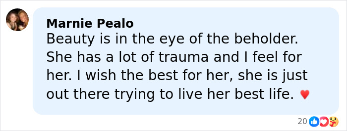 &ldquo;Tragic Tale Of Child Stars&rdquo;: Amanda Bynes&rsquo; New Tattoo Raises Alarm As Fans Call It A “Scream For Help”