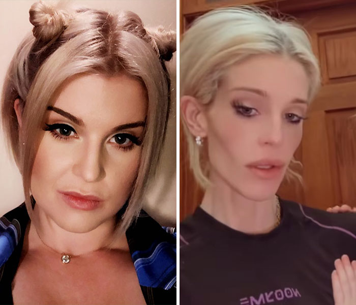 &ldquo;There&rsquo;s No Way This Is Healthy&rdquo;: 30 Celeb Weight Loss Transformations That Sparked Fan Concern