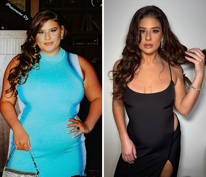 &ldquo;There&rsquo;s No Way This Is Healthy&rdquo;: 30 Celeb Weight Loss Transformations That Sparked Fan Concern