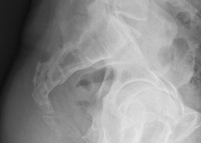 “He was Severely Bullied”: 83 Rare Physiological Traits That Most People Will Never See In Person