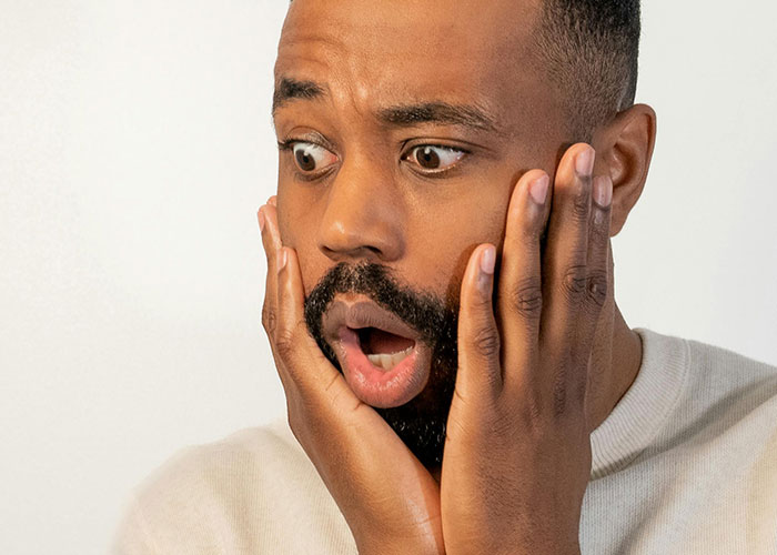 “He was Severely Bullied”: 83 Rare Physiological Traits That Most People Will Never See In Person