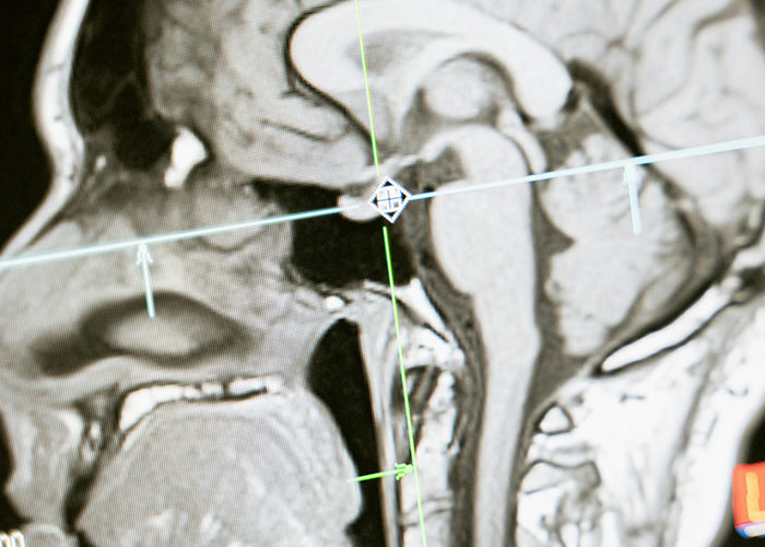 “He was Severely Bullied”: 83 Rare Physiological Traits That Most People Will Never See In Person