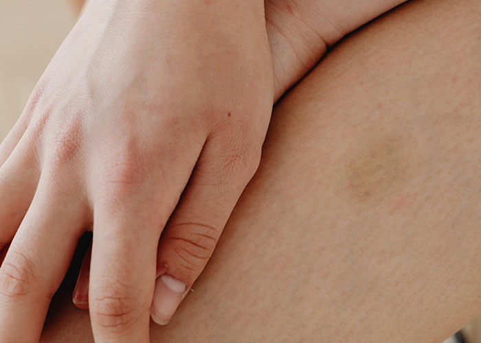 “He was Severely Bullied”: 83 Rare Physiological Traits That Most People Will Never See In Person