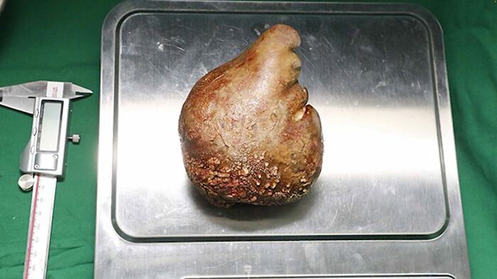 46 Obscure And Weird Medical Facts