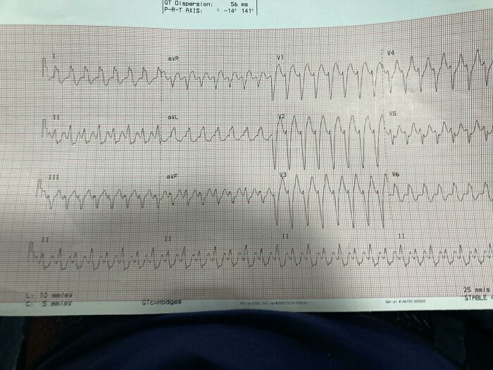 46 Obscure And Weird Medical Facts