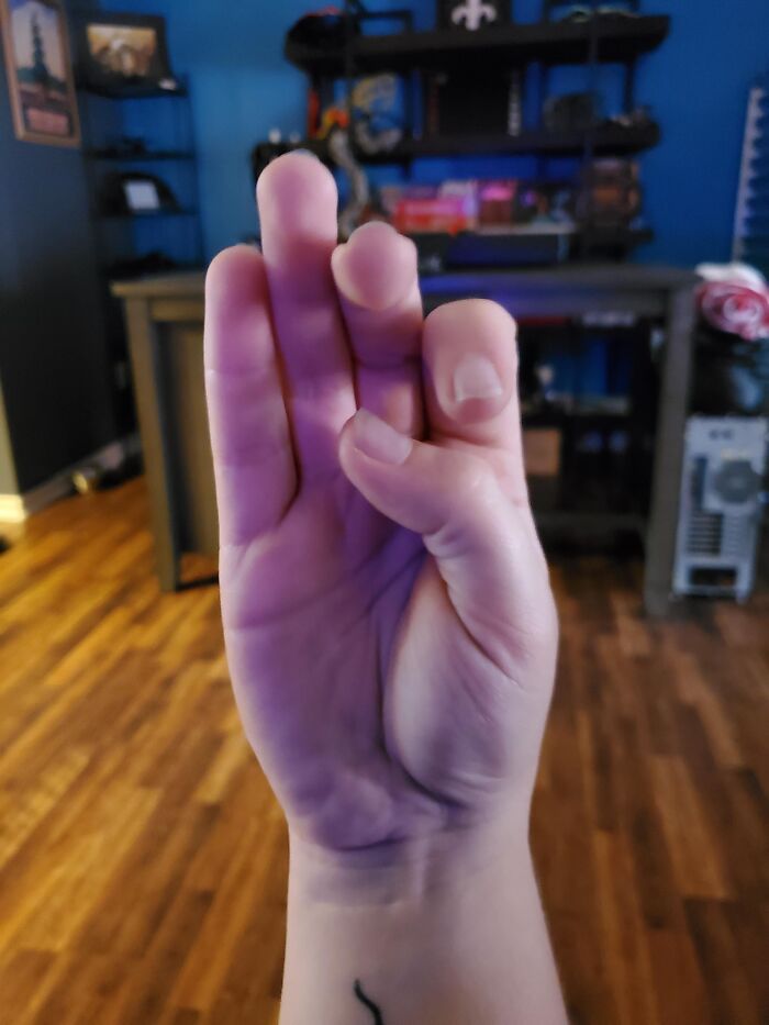 46 Obscure And Weird Medical Facts