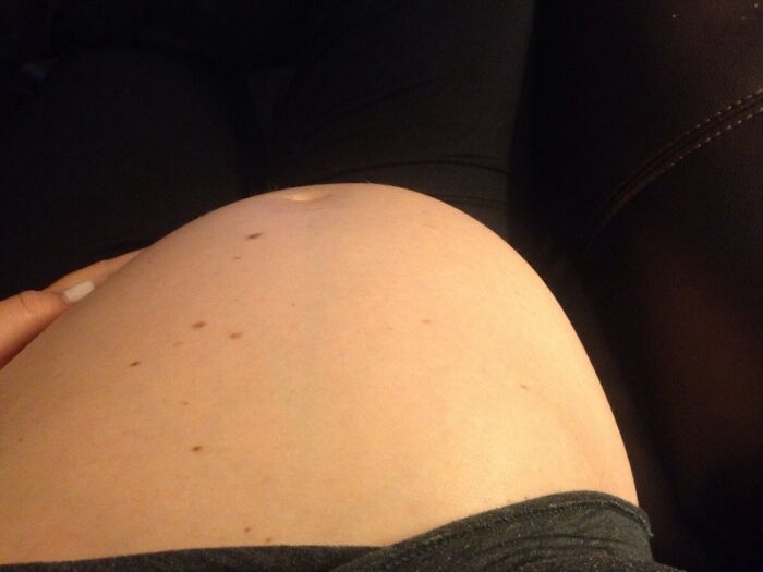 54 Horrible Things About Being Pregnant And Giving Birth That Should Be More Commonly Known