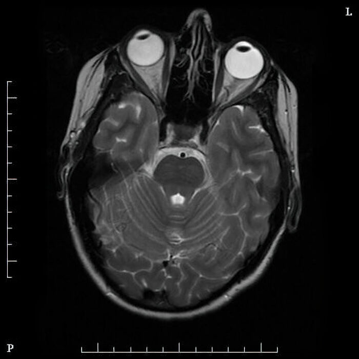 62 Medical Facts That Sound Made Up Even Though They Are True 62 Medical Facts That Sound Made Up Even Though They Are True