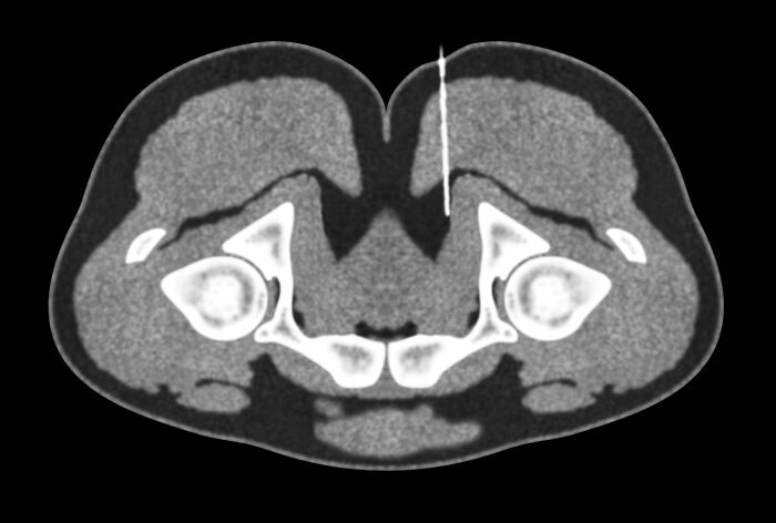 62 Medical Facts That Sound Made Up Even Though They Are True 62 Medical Facts That Sound Made Up Even Though They Are True