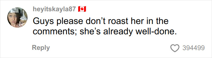 Woman’s Video Goes Viral After She Shows How Her Body Looks After Using A Heating Pad: “Toasted Skin Syndrome”