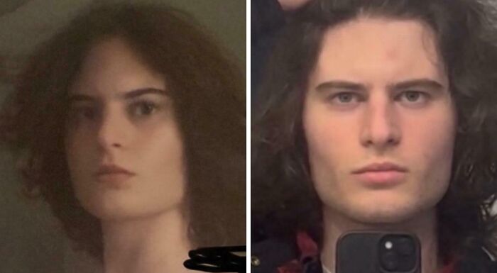 41 People Who Got Plastic Surgery And Now Look Like A Whole New Version Of Themselves 41 People Who Got Plastic Surgery And Now Look Like A Whole New Version Of Themselves