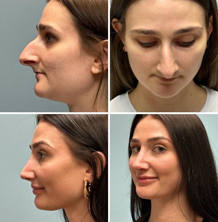 41 People Who Got Plastic Surgery And Now Look Like A Whole New Version Of Themselves 41 People Who Got Plastic Surgery And Now Look Like A Whole New Version Of Themselves