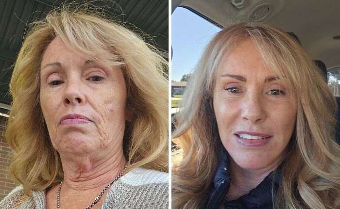 41 People Who Got Plastic Surgery And Now Look Like A Whole New Version Of Themselves 41 People Who Got Plastic Surgery And Now Look Like A Whole New Version Of Themselves