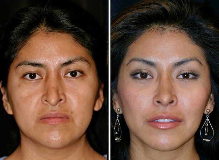 41 People Who Got Plastic Surgery And Now Look Like A Whole New Version Of Themselves 41 People Who Got Plastic Surgery And Now Look Like A Whole New Version Of Themselves