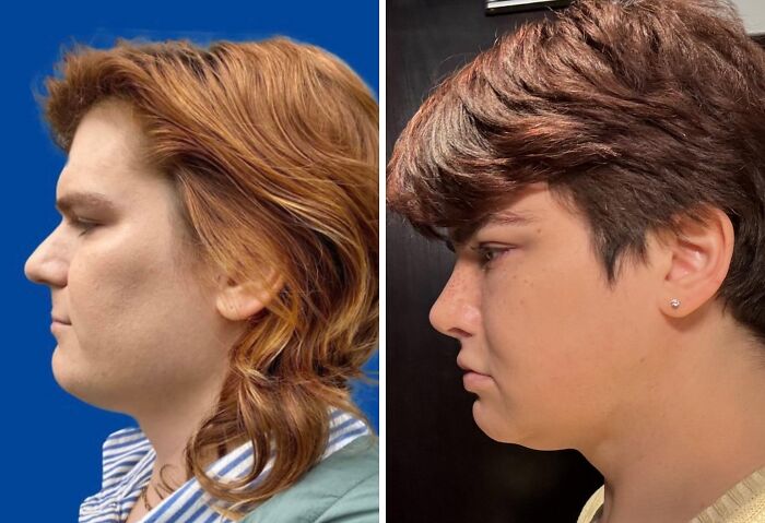 41 People Who Got Plastic Surgery And Now Look Like A Whole New Version Of Themselves 41 People Who Got Plastic Surgery And Now Look Like A Whole New Version Of Themselves