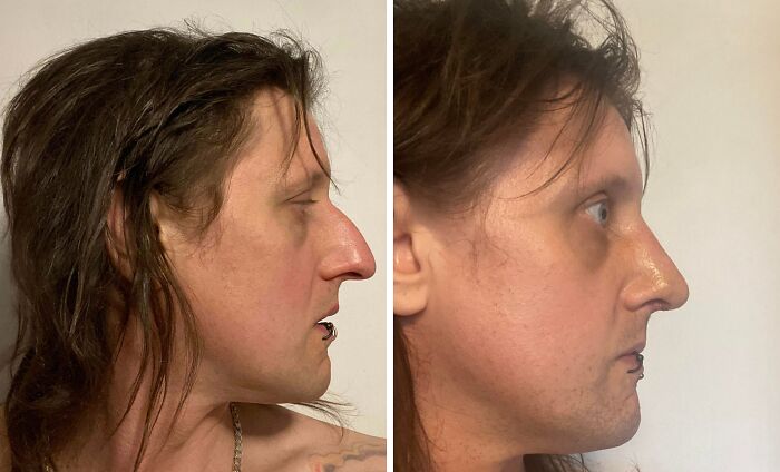 41 People Who Got Plastic Surgery And Now Look Like A Whole New Version Of Themselves 41 People Who Got Plastic Surgery And Now Look Like A Whole New Version Of Themselves