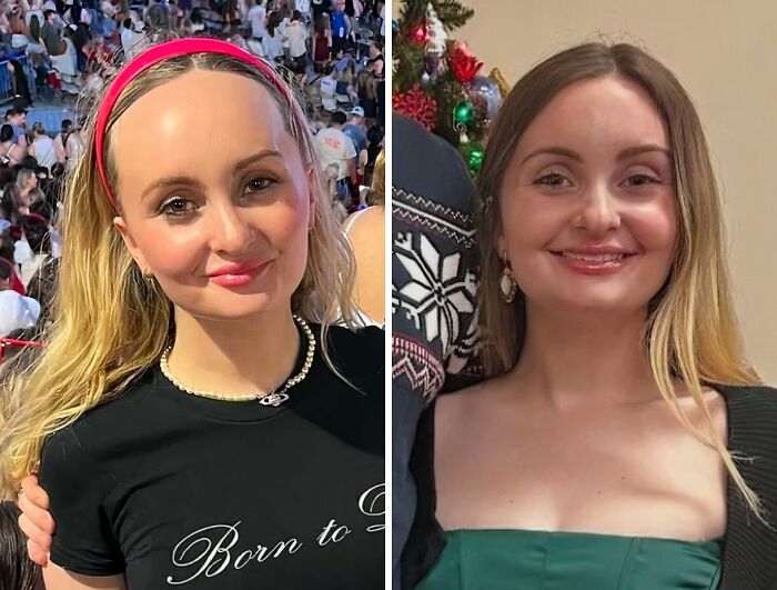 41 People Who Got Plastic Surgery And Now Look Like A Whole New Version Of Themselves 41 People Who Got Plastic Surgery And Now Look Like A Whole New Version Of Themselves