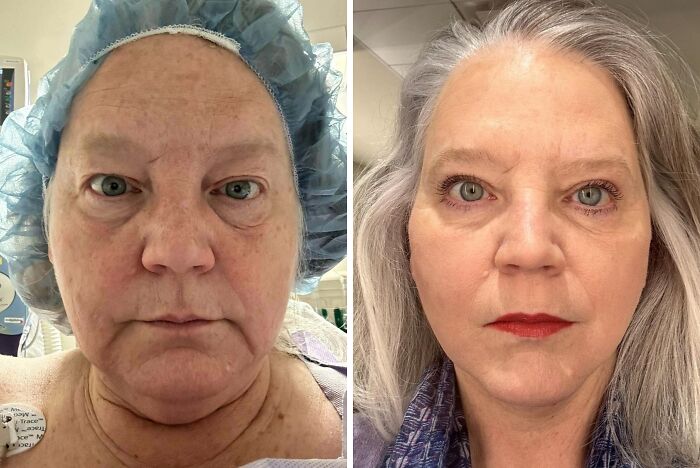 41 People Who Got Plastic Surgery And Now Look Like A Whole New Version Of Themselves 41 People Who Got Plastic Surgery And Now Look Like A Whole New Version Of Themselves