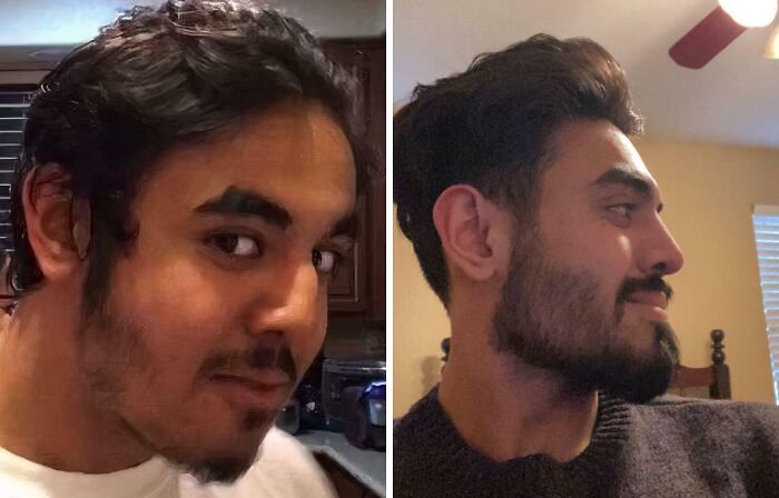 41 People Who Got Plastic Surgery And Now Look Like A Whole New Version Of Themselves 41 People Who Got Plastic Surgery And Now Look Like A Whole New Version Of Themselves