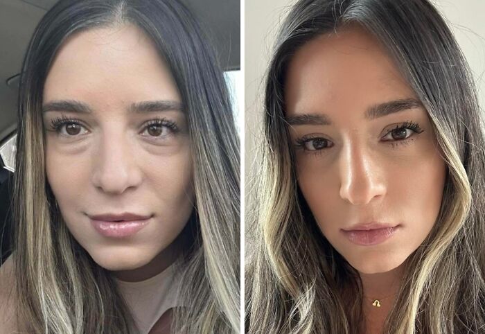 41 People Who Got Plastic Surgery And Now Look Like A Whole New Version Of Themselves 41 People Who Got Plastic Surgery And Now Look Like A Whole New Version Of Themselves