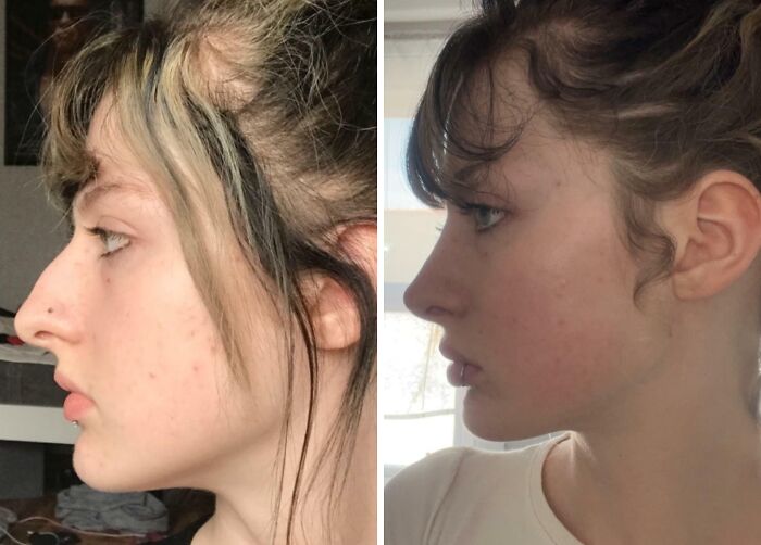 41 People Who Got Plastic Surgery And Now Look Like A Whole New Version Of Themselves 41 People Who Got Plastic Surgery And Now Look Like A Whole New Version Of Themselves