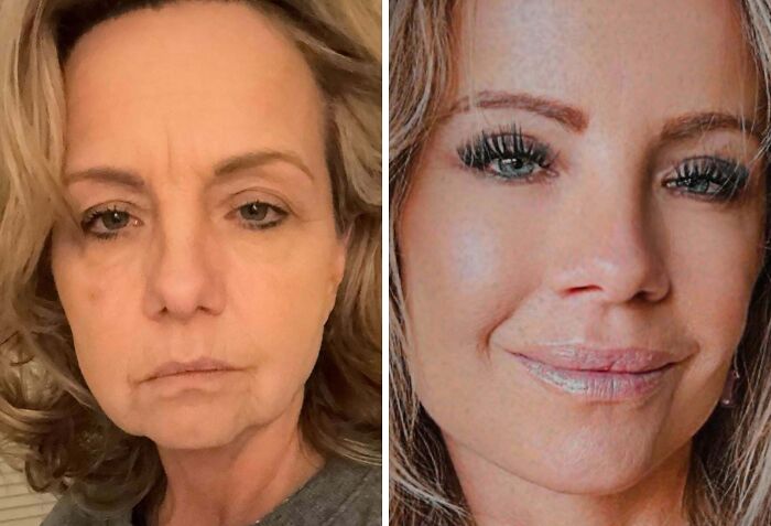 41 People Who Got Plastic Surgery And Now Look Like A Whole New Version Of Themselves 41 People Who Got Plastic Surgery And Now Look Like A Whole New Version Of Themselves