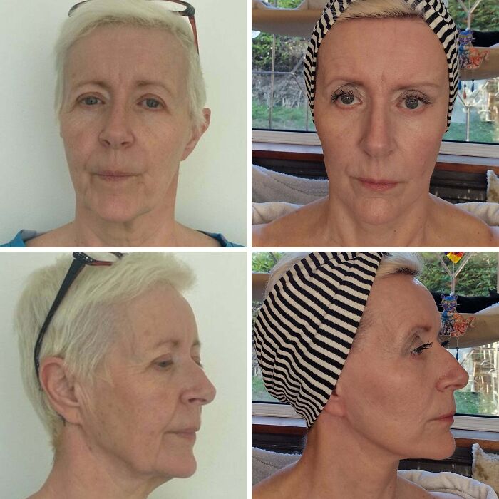 41 People Who Got Plastic Surgery And Now Look Like A Whole New Version Of Themselves 41 People Who Got Plastic Surgery And Now Look Like A Whole New Version Of Themselves