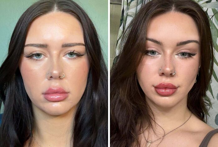 41 People Who Got Plastic Surgery And Now Look Like A Whole New Version Of Themselves 41 People Who Got Plastic Surgery And Now Look Like A Whole New Version Of Themselves
