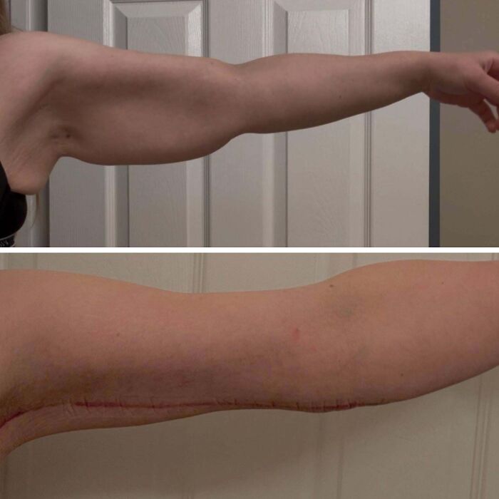 41 People Who Got Plastic Surgery And Now Look Like A Whole New Version Of Themselves 41 People Who Got Plastic Surgery And Now Look Like A Whole New Version Of Themselves