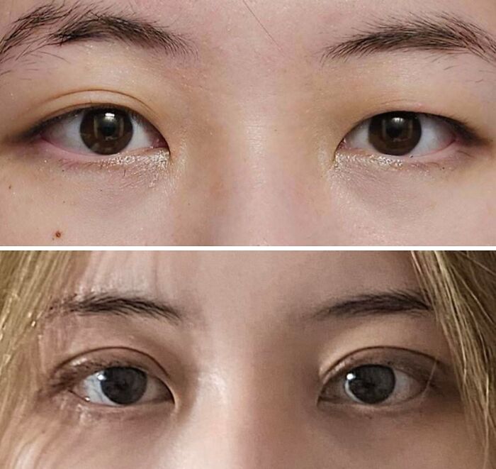 41 People Who Got Plastic Surgery And Now Look Like A Whole New Version Of Themselves 41 People Who Got Plastic Surgery And Now Look Like A Whole New Version Of Themselves