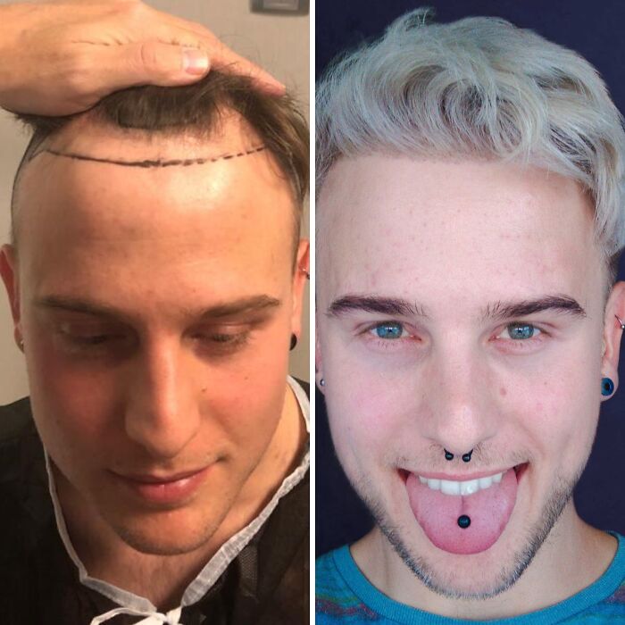 41 People Who Got Plastic Surgery And Now Look Like A Whole New Version Of Themselves 41 People Who Got Plastic Surgery And Now Look Like A Whole New Version Of Themselves