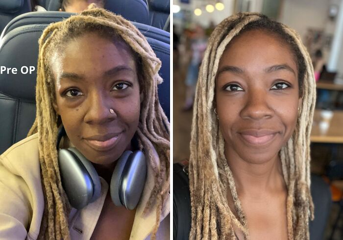 41 People Who Got Plastic Surgery And Now Look Like A Whole New Version Of Themselves 41 People Who Got Plastic Surgery And Now Look Like A Whole New Version Of Themselves