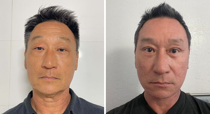 41 People Who Got Plastic Surgery And Now Look Like A Whole New Version Of Themselves 41 People Who Got Plastic Surgery And Now Look Like A Whole New Version Of Themselves