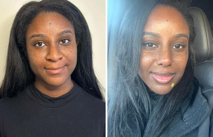 41 People Who Got Plastic Surgery And Now Look Like A Whole New Version Of Themselves 41 People Who Got Plastic Surgery And Now Look Like A Whole New Version Of Themselves