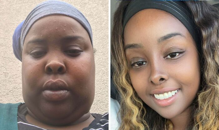 41 People Who Got Plastic Surgery And Now Look Like A Whole New Version Of Themselves 41 People Who Got Plastic Surgery And Now Look Like A Whole New Version Of Themselves