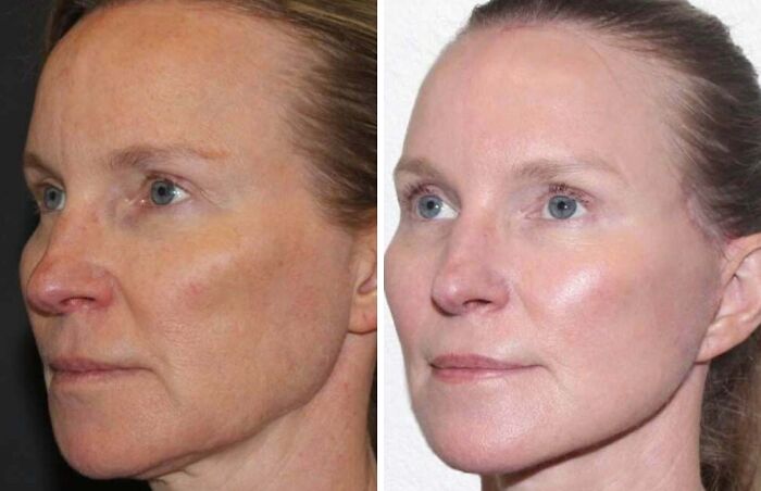 41 People Who Got Plastic Surgery And Now Look Like A Whole New Version Of Themselves 41 People Who Got Plastic Surgery And Now Look Like A Whole New Version Of Themselves