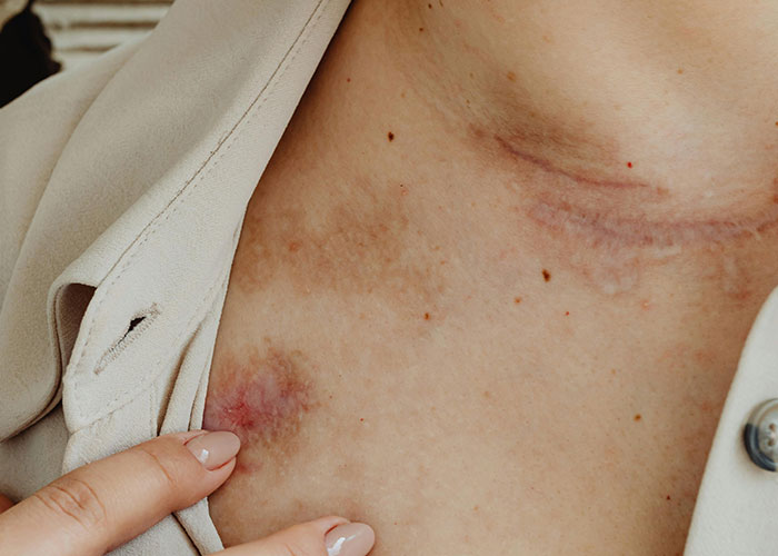 “I Had No Idea Until It Happened To Me”: 70 Medical Issues People Wouldn’t Wish Upon Their Worst Enemy “I Had No Idea Until It Happened To Me”: 70 Medical Issues People Wouldn’t Wish Upon Their Worst Enemy