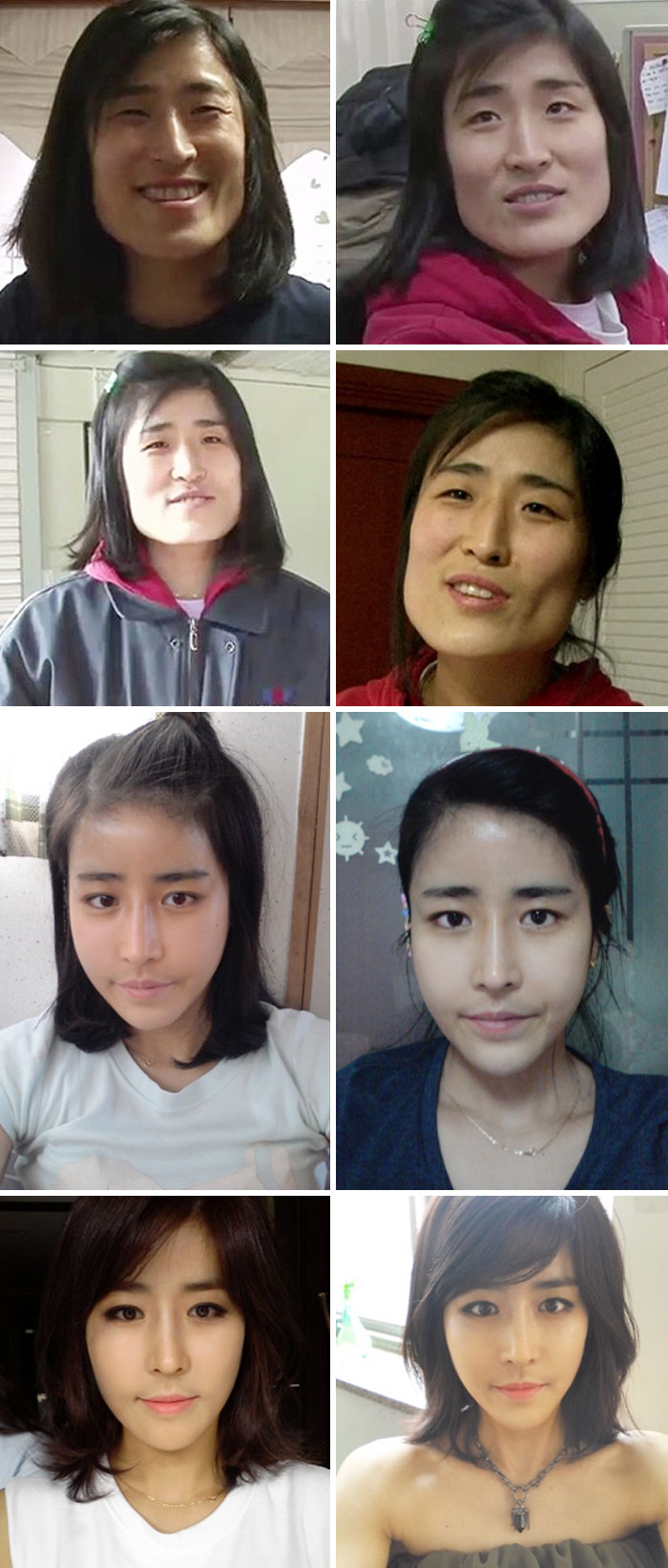 49 Of The Most Dramatic Before And After Pics