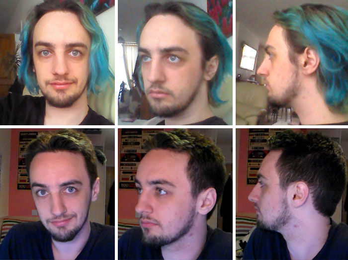 49 Of The Most Dramatic Before And After Pics