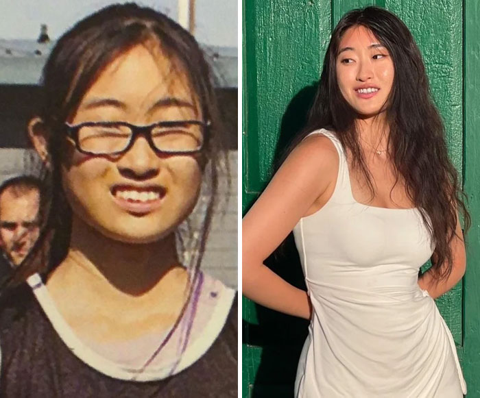 49 Of The Most Dramatic Before And After Pics