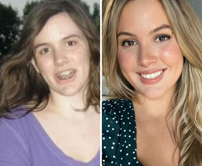 49 Of The Most Dramatic Before And After Pics