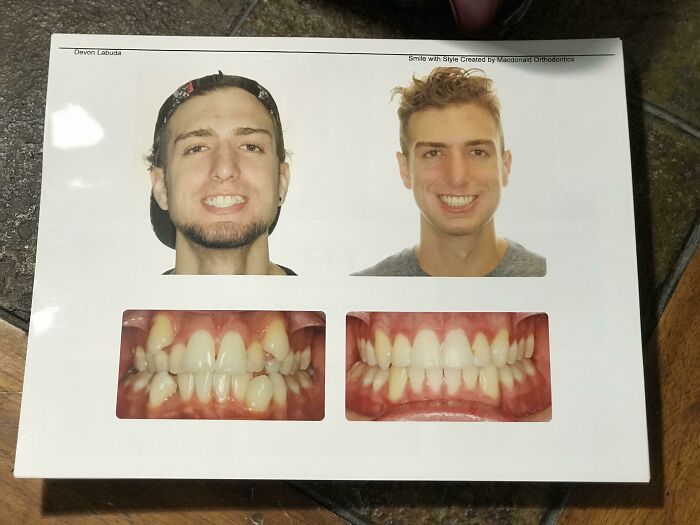 49 Of The Most Dramatic Before And After Pics