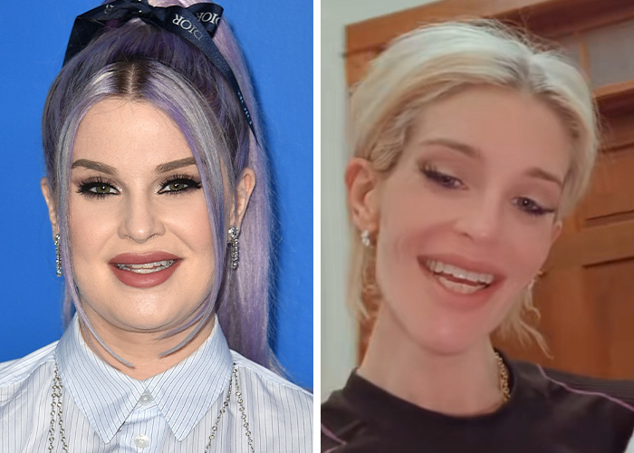 Extremely Skinny Look Of Ryan Seacrest&rsquo;s Face Worries Fans, As Hollywood Trend Seems To Grow